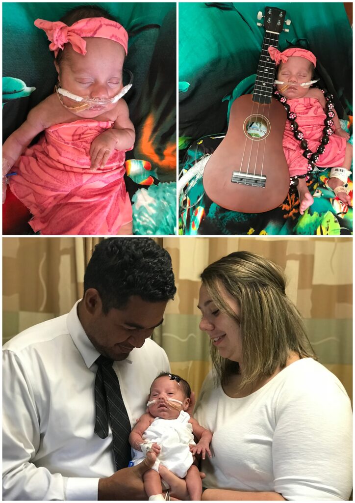 NICU 26 week preemie and a diy newborn photoshoot
